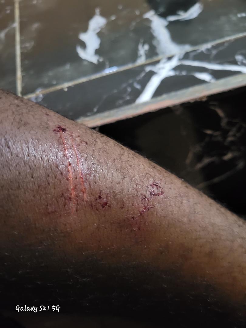 Northern Region: Armed robbers attack NDC youth organiser 2 WhatsApp Image 2024 09 02 at 15.50.11 42611716 Channel1 News Northern Region: Armed robbers attack NDC youth organiser