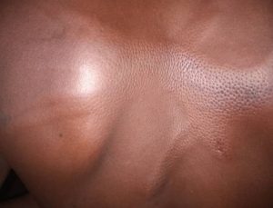 beatings 1 Channel1 News Bawku: Several injured in alleged military retaliation over slain Soldier