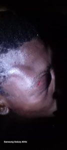 beatings2 Channel1 News Bawku: Several injured in alleged military retaliation over slain Soldier