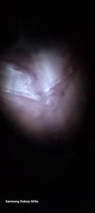 beatings3 Channel1 News Bawku: Several injured in alleged military retaliation over slain Soldier