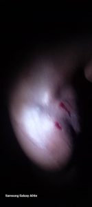 beatings4 Channel1 News Bawku: Several injured in alleged military retaliation over slain Soldier